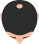 Mild